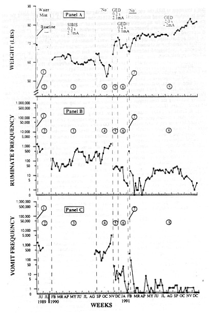 Charting Vomiting